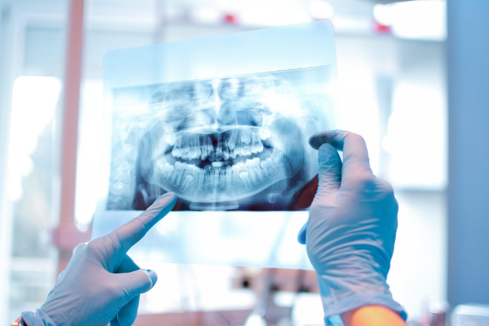 Dental X-Rays Market