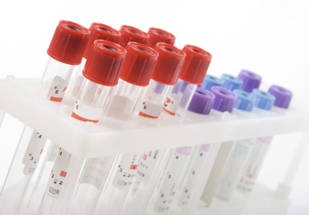 Transfection Reagents Market