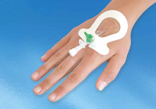 Vascular Access Devices Market Report Includes Dynamics, Products, and Application 2017 – 2032