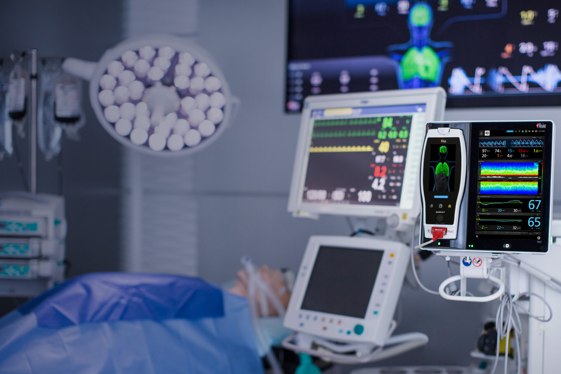 Medical Capnography Device Market Statistics and Growth Trends Analysis Forecast 2017 – 2032