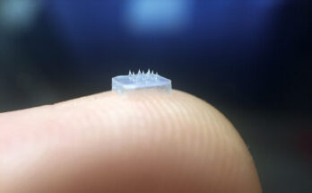 Biodegradable Microneedle Patch Market