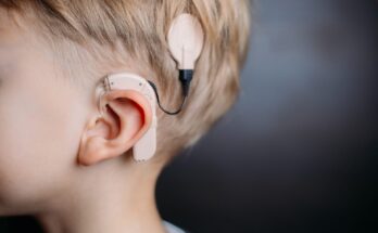Cochlear Implant (CI) Market