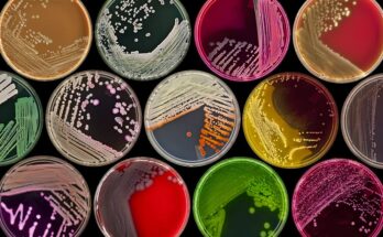 Microbial Cultures Market