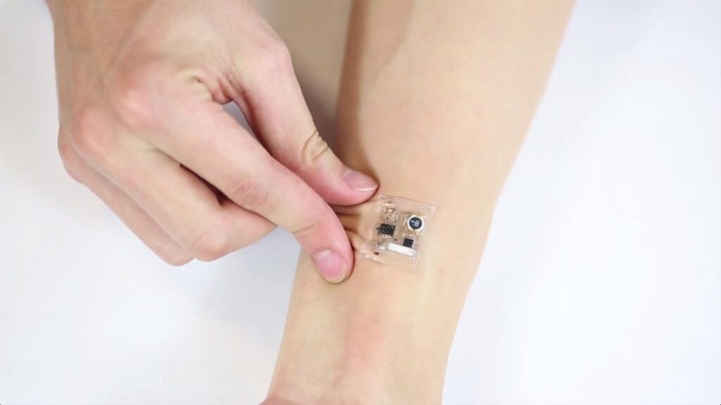 Body Sensor Patches Market