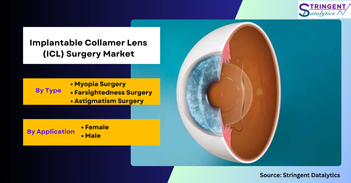 Implantable Collamer Lens (ICL) Surgery Market Overview Analysis, Trends, Share, Size, Type & Future Forecast to 2032