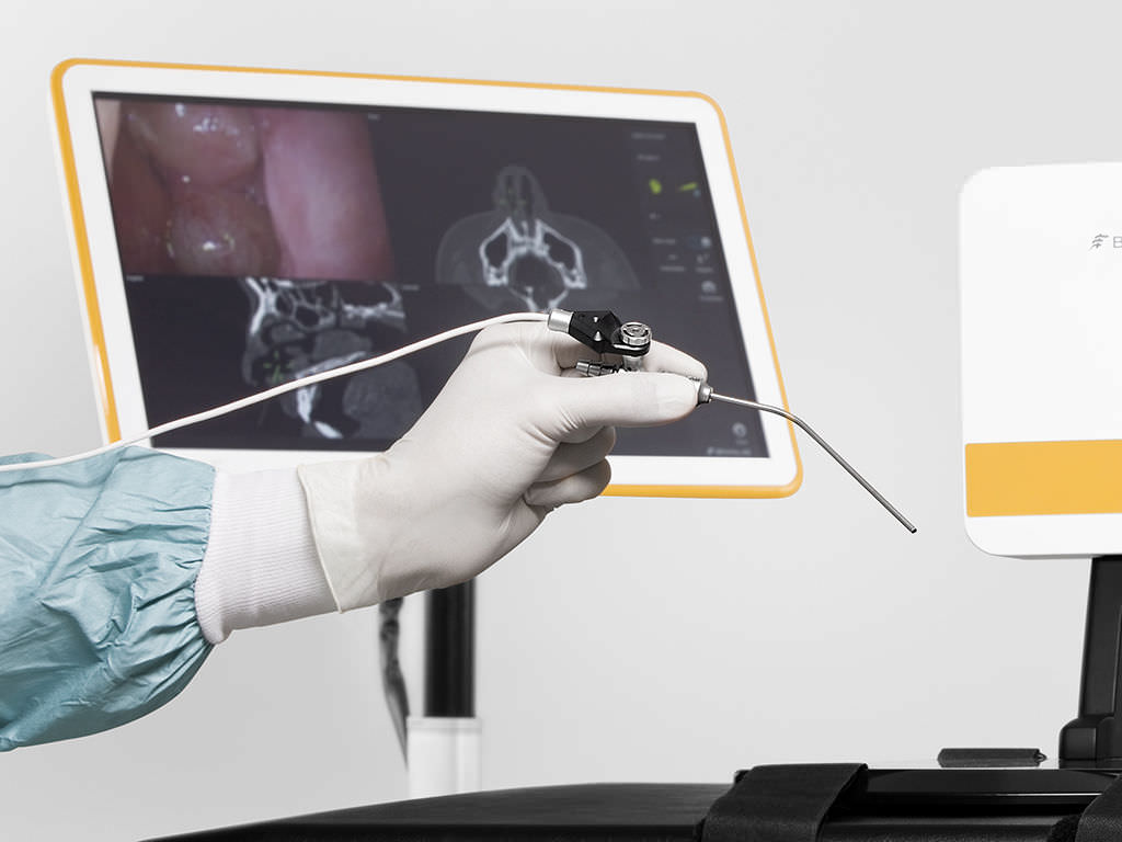 Electromagnetic Navigation Bronchoscopy (ENB) Market Analysis Key Trends, Growth Opportunities, Challenges, Key Players, End User Demand and Forecasts to 2033