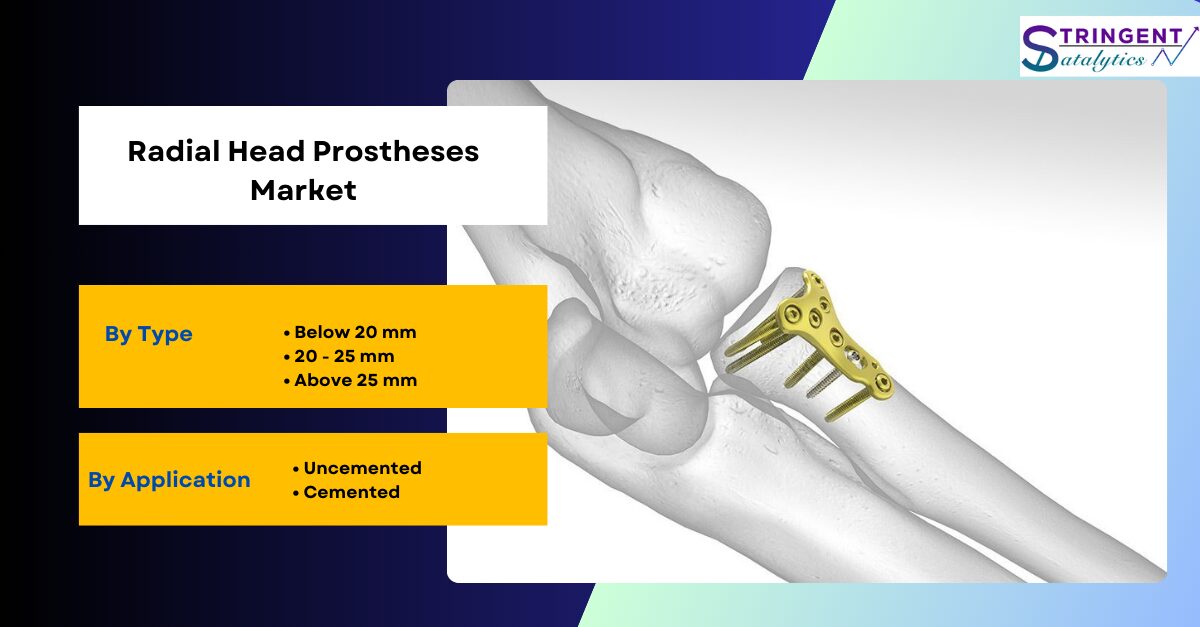 Radial Head Prostheses Market Key Vendors, Segment, Growth Opportunities by 2024 to 2033