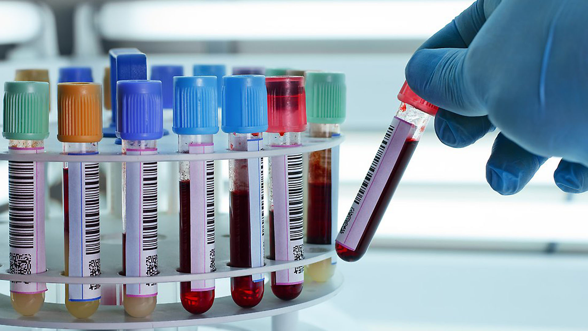 Blood Test Analysis Software Market