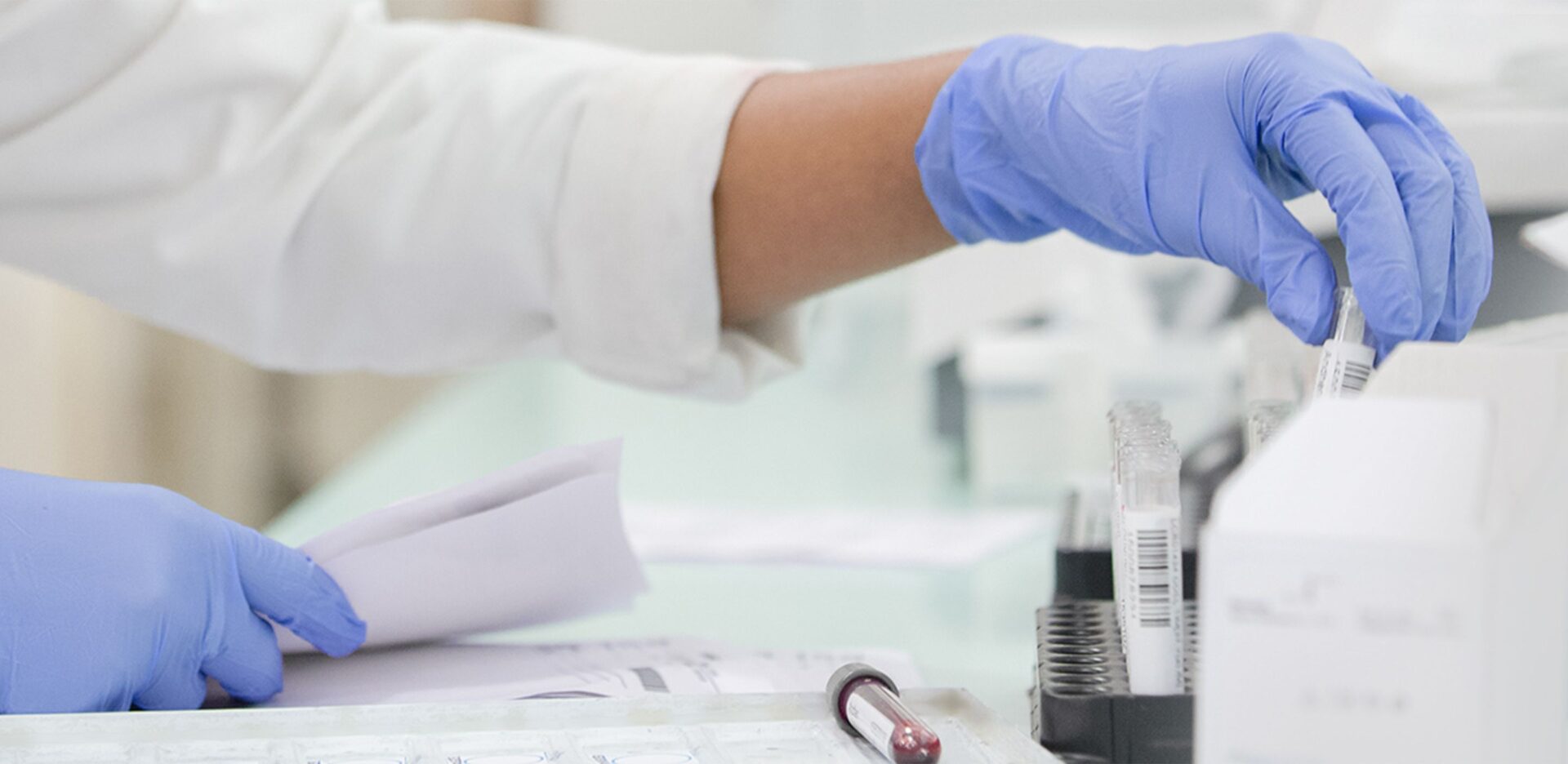 Hepatitis Diagnostic Test Market