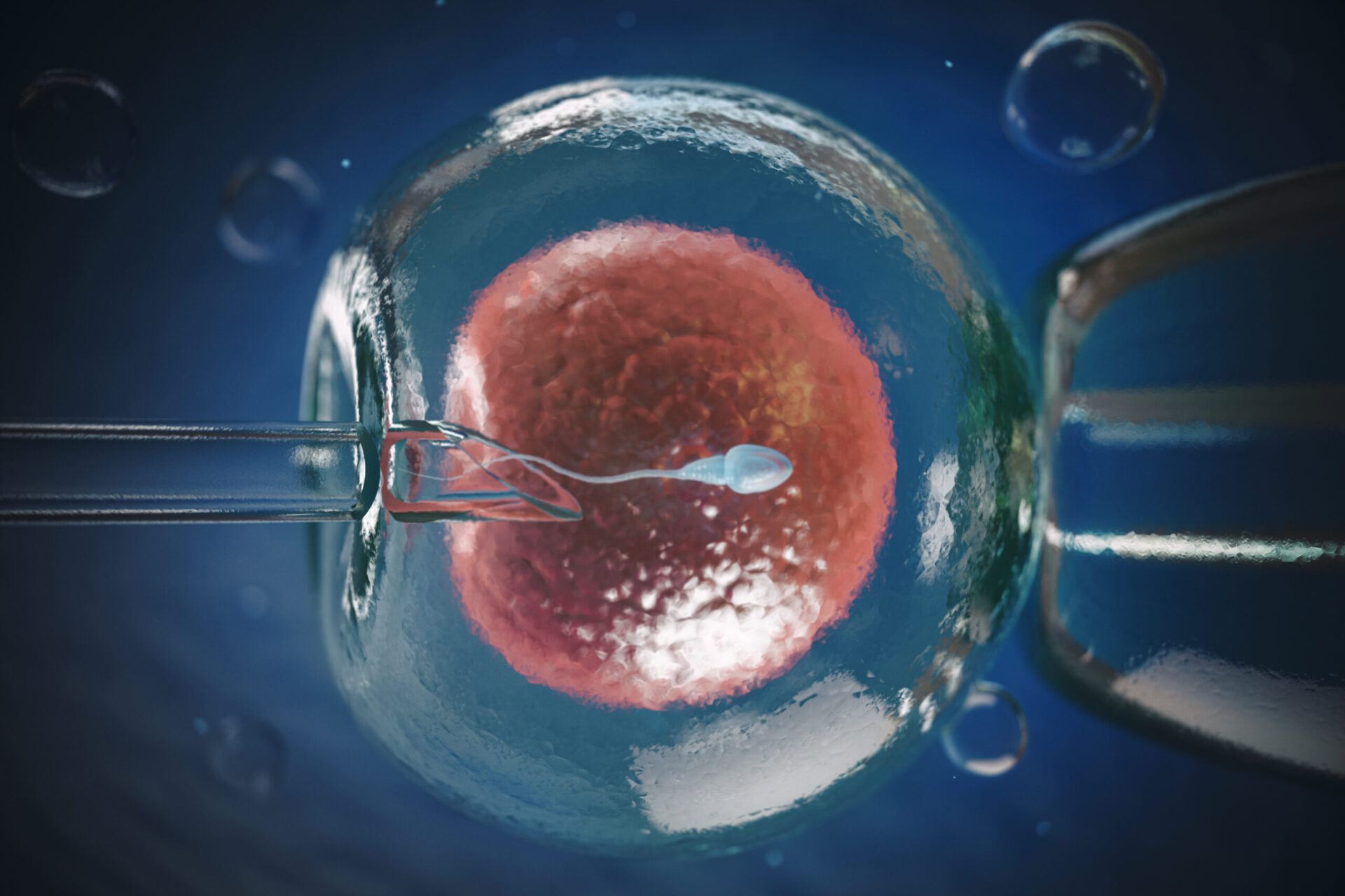 In-Vitro Fertilization (IVF) Market Opportunities, Segmentation, Assessment and Competitive Strategies by 2033
