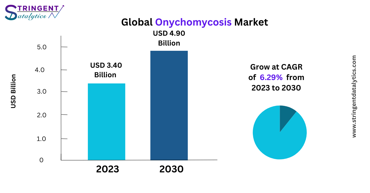 Onychomycosis Market Analysis, Trends, Development and Growth Opportunities by Forecast 2033