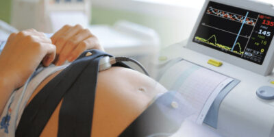 Fetal Activity Monitor Market