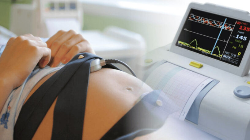 Fetal Activity Monitor Market