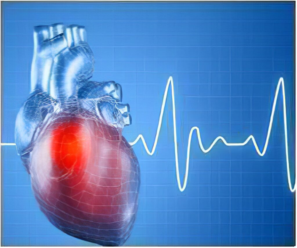 Atrial Fibrillation (AF) Diagnostics Market