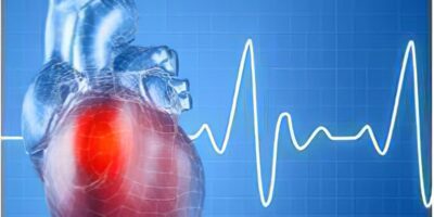 Atrial Fibrillation (AF) Diagnostics Market