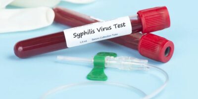 Syphilis Testing Market