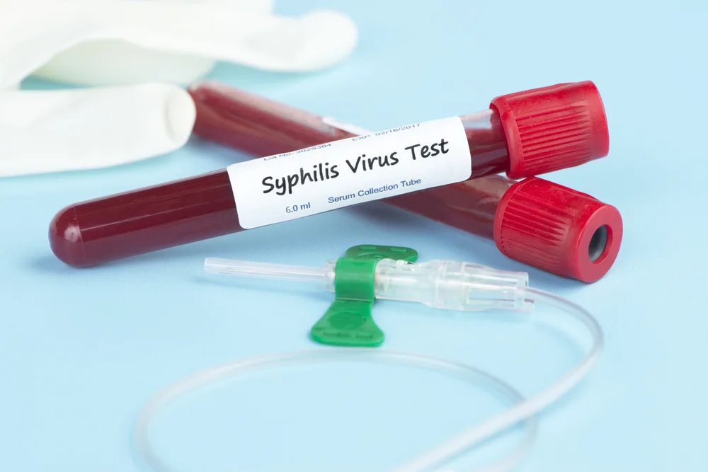 Syphilis Testing Market