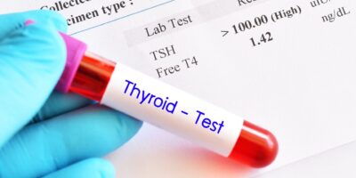 Thyroid Functioning Tests Market