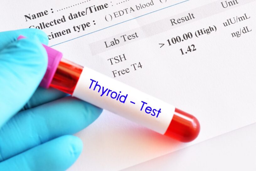 Thyroid Functioning Tests Market