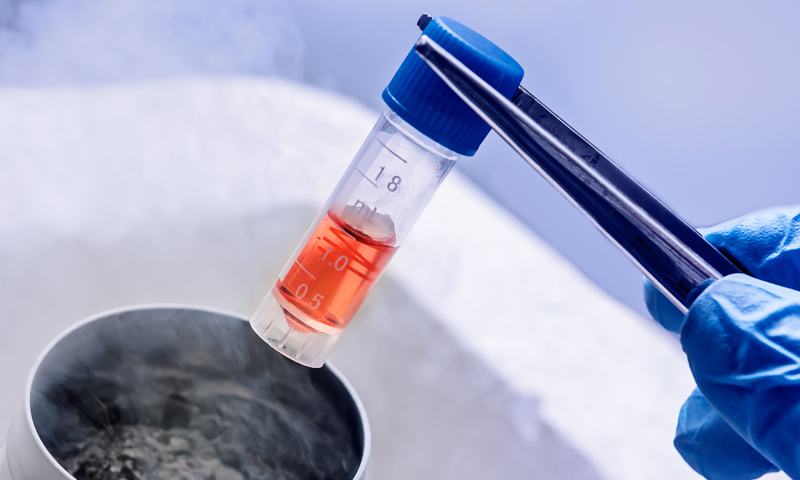 Cryopreservation Equipment in Stem Cells Market