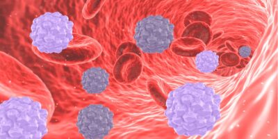 Hematological Malignancies Market