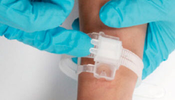 Transradial Access Market