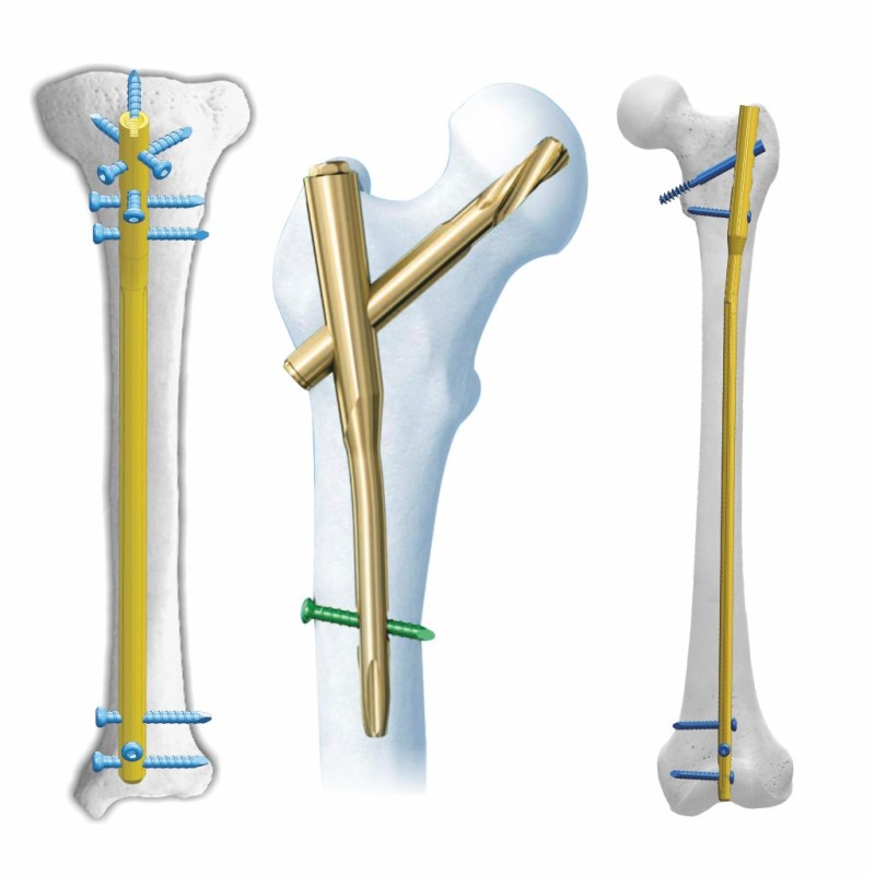 Trauma Products Market