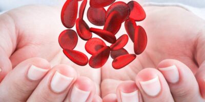 Anemia and Vitamin Test Market