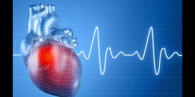 Cardiovascular Surgical Devices and Technologies Market