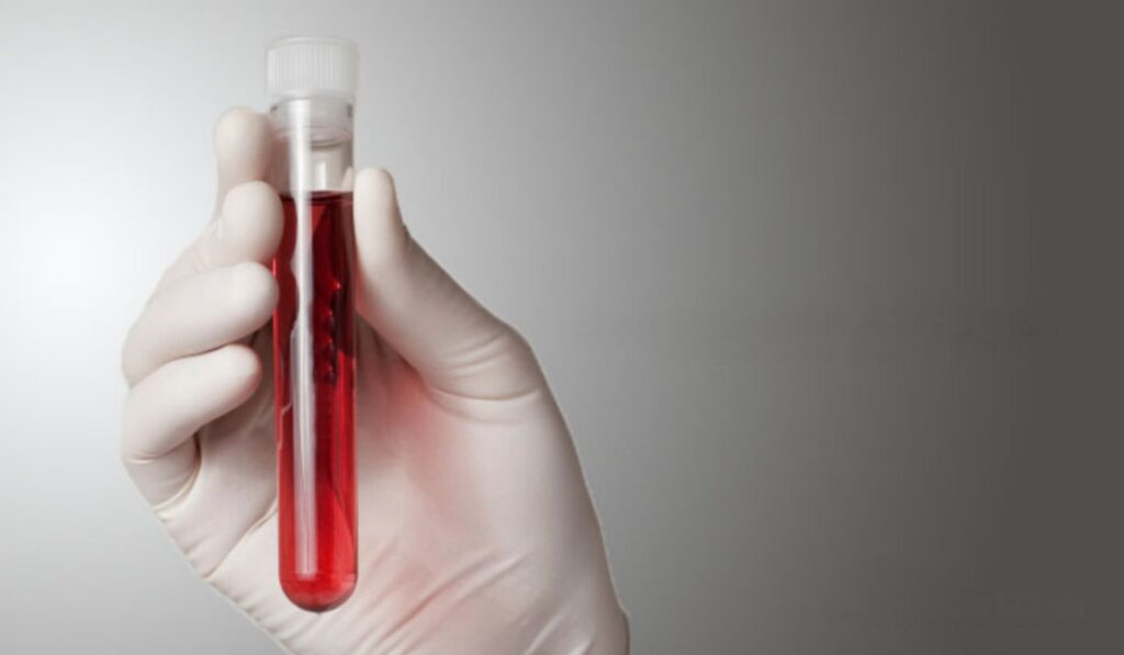 Hemoglobin Testing Market