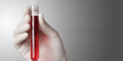 Hemoglobin Testing Market