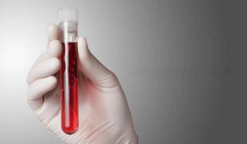 Hemoglobin Testing Market