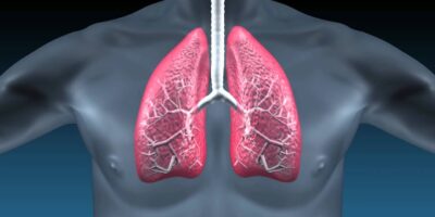 Idiopathic Pulmonary Fibrosis Market