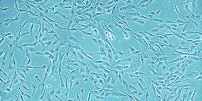 Human Mesenchymal Stem Cells (hMSC) Market