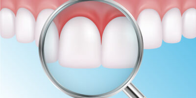 Periodontal Dental Service Market