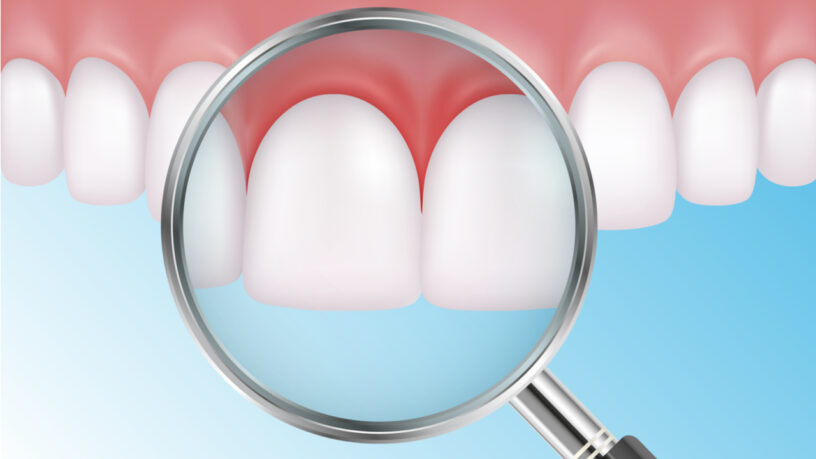 Periodontal Dental Service Market